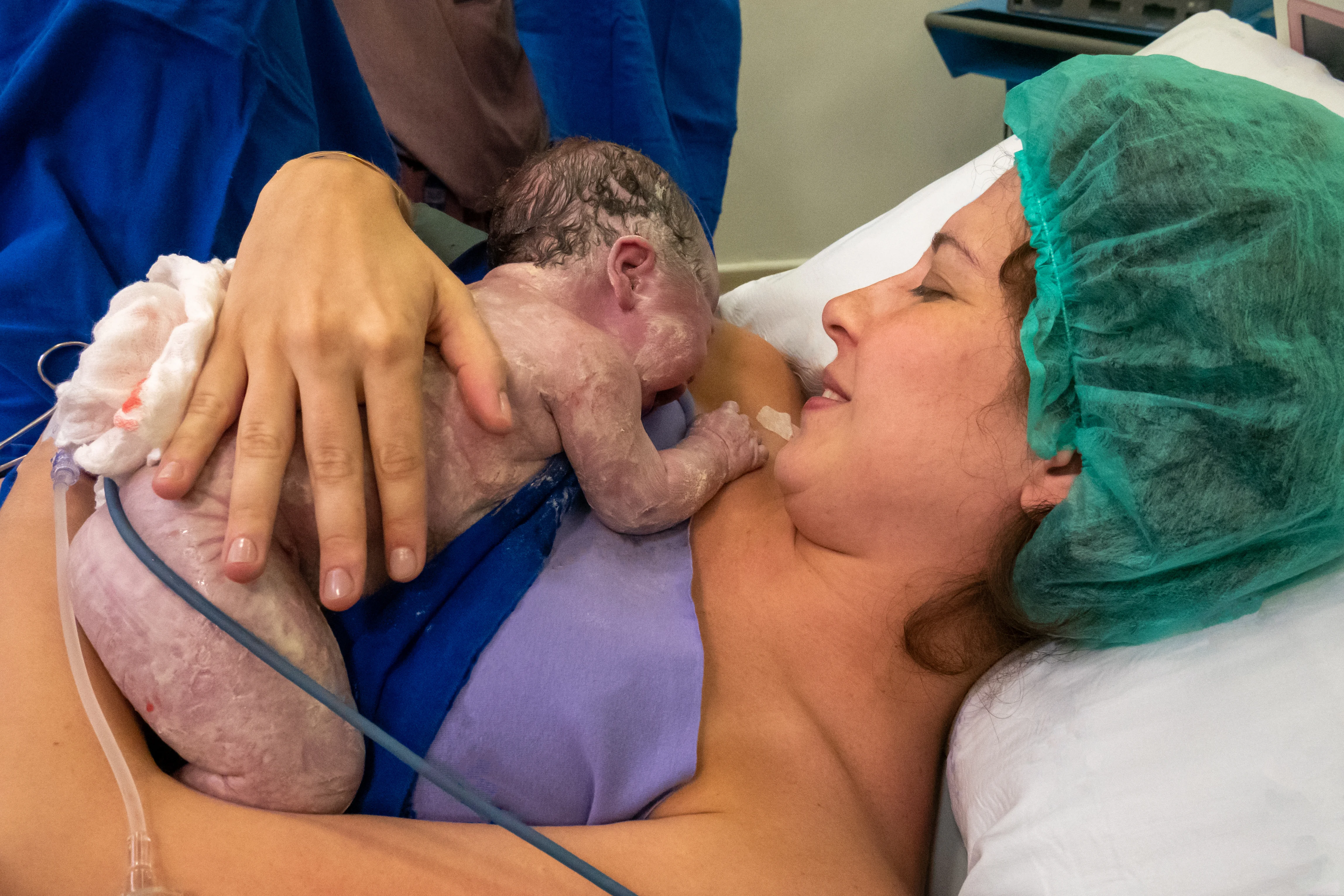 Vaginal Birth After Cesarean