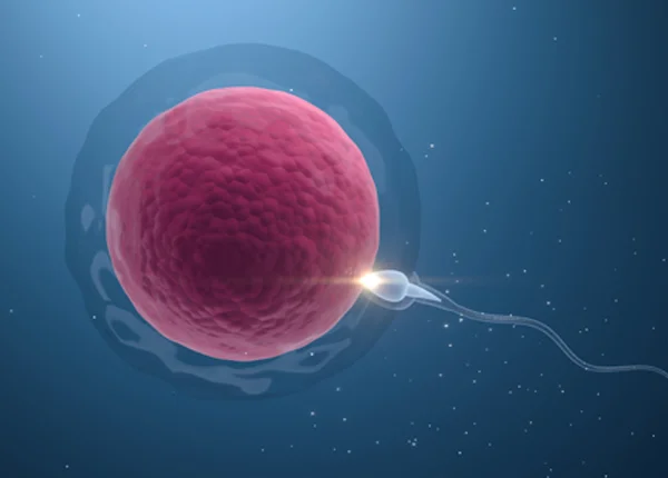 IUI