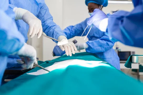 Laparoscopic Myomectomy