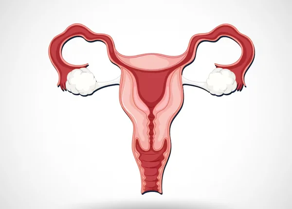 Uterus or Uterine Prolapse Treatment